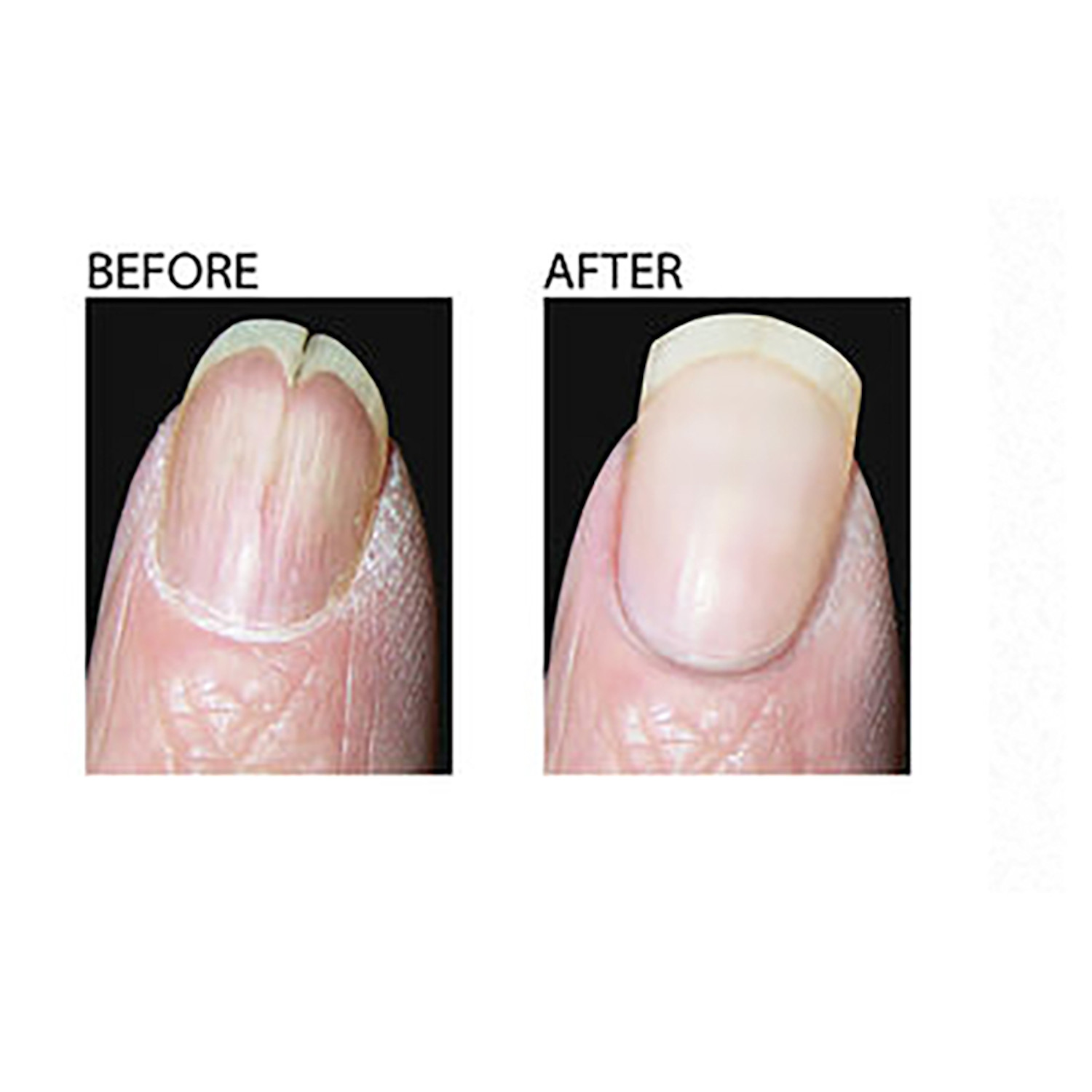 Makeover Ridge Filler Nail Treatment | Support Plus